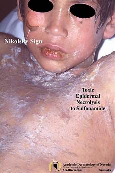 Child Care Products