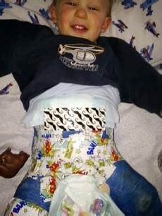 Diaper Side Tape