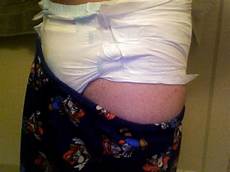 Disposable Diapers